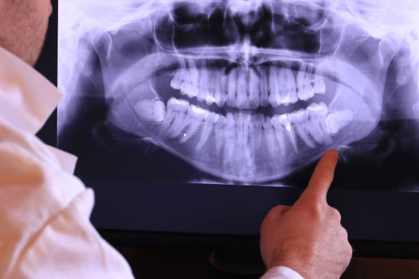 Best Urgent Tooth Repair  in Rawlins, WY