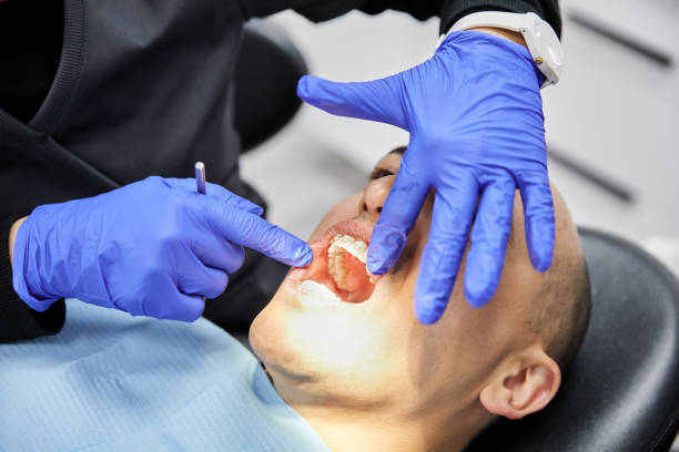 Best Dentist for Tooth Abscess  in Rawlins, WY
